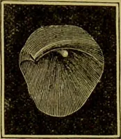 An illustration from Diseases of the ear, nose, and throat and their accessory cavities : A condensed text-book / By Seth Scott Bishop. (1897)