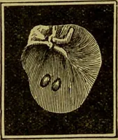 Picture 23 of 65 from Diseases of the ear, nose, and throat and their accessory cavities : A condensed text-book / By Seth Scott Bishop. (1897), leaf 116