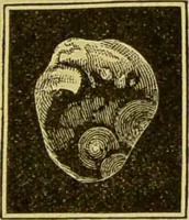 Picture 31 of 65 from Diseases of the ear, nose, and throat and their accessory cavities : A condensed text-book / By Seth Scott Bishop. (1897), leaf 139