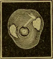 An illustration from Diseases of the ear, nose, and throat and their accessory cavities : A condensed text-book / By Seth Scott Bishop. (1897)