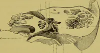 Picture 38 of 65 from Diseases of the ear, nose, and throat and their accessory cavities : A condensed text-book / By Seth Scott Bishop. (1897), leaf 163