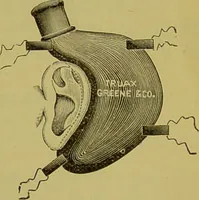 An illustration from Diseases of the ear, nose, and throat and their accessory cavities : A condensed text-book / By Seth Scott Bishop. (1897)
