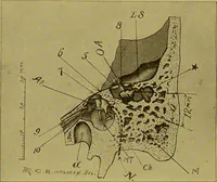 Picture 48 of 65 from Diseases of the ear, nose, and throat and their accessory cavities : A condensed text-book / By Seth Scott Bishop. (1897), leaf 192