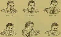 Picture 58 of 65 from Diseases of the ear, nose, and throat and their accessory cavities : A condensed text-book / By Seth Scott Bishop. (1897), leaf 242