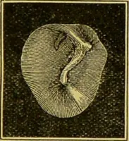 An illustration from Diseases of the ear, nose, and throat and their accessory cavities : A condensed text-book / By Seth Scott Bishop. (1897)
