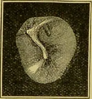 An illustration from Diseases of the ear, nose, and throat and their accessory cavities : A condensed text-book / By Seth Scott Bishop. (1897)