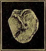 Picture 13 of 65 from Diseases of the ear, nose, and throat and their accessory cavities : A condensed text-book / By Seth Scott Bishop. (1897), leaf 86