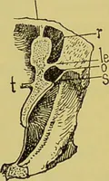 An illustration from Diseases of the ear, nose, and throat and their accessory cavities : A condensed text-book / By Seth Scott Bishop. (1897)