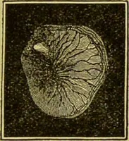 An illustration from Diseases of the ear, nose, and throat and their accessory cavities : A condensed text-book / By Seth Scott Bishop. (1897)