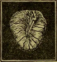 An illustration from Diseases of the ear, nose, and throat and their accessory cavities : A condensed text-book / By Seth Scott Bishop. (1897)