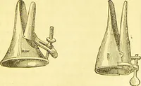 An illustration from Laryngoscopy and rhinoscopy and the diagnosis and treatment of the diseases of the throat and nose / by Prosser James, M.D. (1888)