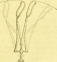 An illustration from Laryngoscopy and rhinoscopy and the diagnosis and treatment of the diseases of the throat and nose / by Prosser James, M.D. (1888)