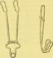 An illustration from Laryngoscopy and rhinoscopy and the diagnosis and treatment of the diseases of the throat and nose / by Prosser James, M.D. (1888)
