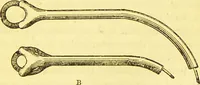 An illustration from Laryngoscopy and rhinoscopy and the diagnosis and treatment of the diseases of the throat and nose / by Prosser James, M.D. (1888)
