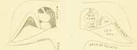Picture 1 of 42 from Laryngoscopy and rhinoscopy and the diagnosis and treatment of the diseases of the throat and nose / by Prosser James, M.D. (1888), leaf 23