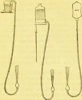 An illustration from Laryngoscopy and rhinoscopy and the diagnosis and treatment of the diseases of the throat and nose / by Prosser James, M.D. (1888)