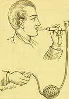 An illustration from Laryngoscopy and rhinoscopy and the diagnosis and treatment of the diseases of the throat and nose / by Prosser James, M.D. (1888)