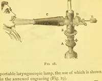 Picture 13 of 42 from Laryngoscopy and rhinoscopy and the diagnosis and treatment of the diseases of the throat and nose / by Prosser James, M.D. (1888), leaf 36