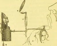 An illustration from Laryngoscopy and rhinoscopy and the diagnosis and treatment of the diseases of the throat and nose / by Prosser James, M.D. (1888)