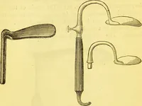 An illustration from Laryngoscopy and rhinoscopy and the diagnosis and treatment of the diseases of the throat and nose / by Prosser James, M.D. (1888)