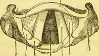 An illustration from Laryngoscopy and rhinoscopy and the diagnosis and treatment of the diseases of the throat and nose / by Prosser James, M.D. (1888)