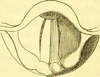 An illustration from Laryngoscopy and rhinoscopy and the diagnosis and treatment of the diseases of the throat and nose / by Prosser James, M.D. (1888)
