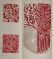 An illustration from Lectures on the diseases of the kidney, generally known as "Brights' disease", and dropsy / by S. J. Goodfellow. (1861)