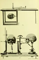 An illustration from Norrønaskaller : crania antiqua in parte orientali Norvegiae meridionalis inventa / en studie fra Universitetets Anatomiske Institut og dette tilegnet af Justus Barth ... ; udgivet ved G.A. Guldberg. (1896)