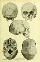 An illustration from Norrønaskaller : crania antiqua in parte orientali Norvegiae meridionalis inventa / en studie fra Universitetets Anatomiske Institut og dette tilegnet af Justus Barth ... ; udgivet ved G.A. Guldberg. (1896)