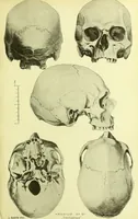 An illustration from Norrønaskaller : crania antiqua in parte orientali Norvegiae meridionalis inventa / en studie fra Universitetets Anatomiske Institut og dette tilegnet af Justus Barth ... ; udgivet ved G.A. Guldberg. (1896)