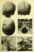 An illustration from Norrønaskaller : crania antiqua in parte orientali Norvegiae meridionalis inventa / en studie fra Universitetets Anatomiske Institut og dette tilegnet af Justus Barth ... ; udgivet ved G.A. Guldberg. (1896)