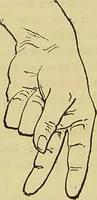 An illustration from Le magnétisme animal / par Alfred Binet et Ch. Féré. (1887)