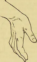 An illustration from Le magnétisme animal / par Alfred Binet et Ch. Féré. (1887)