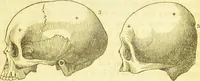 An illustration from Elements of phrenology / by George Combe. (1836)