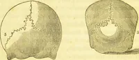 An illustration from Elements of phrenology / by George Combe. (1836)