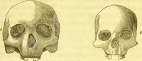 An illustration from Elements of phrenology / by George Combe. (1836)