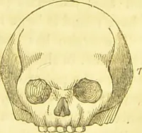 An illustration from Elements of phrenology / by George Combe. (1836)