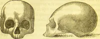 An illustration from Elements of phrenology / by George Combe. (1836)