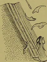 An illustration from Clinical diagnosis : the bacteriological, chemical, and microscopical evidence of disease / By Dr. Rudolf v. Jaksch, ... Translated from the third German edition and enlarged by James Cagney, ... With numerous illustrations (partly in colours). (1893)