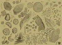 An illustration from Clinical diagnosis : the bacteriological, chemical, and microscopical evidence of disease / By Dr. Rudolf v. Jaksch, ... Translated from the third German edition and enlarged by James Cagney, ... With numerous illustrations (partly in colours). (1893)