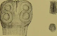 An illustration from Clinical diagnosis : the bacteriological, chemical, and microscopical evidence of disease / By Dr. Rudolf v. Jaksch, ... Translated from the third German edition and enlarged by James Cagney, ... With numerous illustrations (partly in colours). (1893)