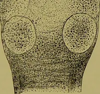 An illustration from Clinical diagnosis : the bacteriological, chemical, and microscopical evidence of disease / By Dr. Rudolf v. Jaksch, ... Translated from the third German edition and enlarged by James Cagney, ... With numerous illustrations (partly in colours). (1893)