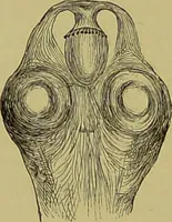 An illustration from Clinical diagnosis : the bacteriological, chemical, and microscopical evidence of disease / By Dr. Rudolf v. Jaksch, ... Translated from the third German edition and enlarged by James Cagney, ... With numerous illustrations (partly in colours). (1893)