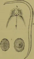 An illustration from Clinical diagnosis : the bacteriological, chemical, and microscopical evidence of disease / By Dr. Rudolf v. Jaksch, ... Translated from the third German edition and enlarged by James Cagney, ... With numerous illustrations (partly in colours). (1893)