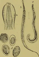 An illustration from Clinical diagnosis : the bacteriological, chemical, and microscopical evidence of disease / By Dr. Rudolf v. Jaksch, ... Translated from the third German edition and enlarged by James Cagney, ... With numerous illustrations (partly in colours). (1893)