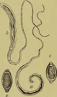 An illustration from Clinical diagnosis : the bacteriological, chemical, and microscopical evidence of disease / By Dr. Rudolf v. Jaksch, ... Translated from the third German edition and enlarged by James Cagney, ... With numerous illustrations (partly in colours). (1893)