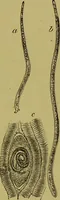 An illustration from Clinical diagnosis : the bacteriological, chemical, and microscopical evidence of disease / By Dr. Rudolf v. Jaksch, ... Translated from the third German edition and enlarged by James Cagney, ... With numerous illustrations (partly in colours). (1893)