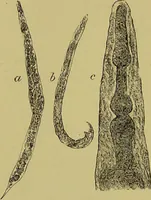An illustration from Clinical diagnosis : the bacteriological, chemical, and microscopical evidence of disease / By Dr. Rudolf v. Jaksch, ... Translated from the third German edition and enlarged by James Cagney, ... With numerous illustrations (partly in colours). (1893)