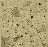 An illustration from Clinical diagnosis : the bacteriological, chemical, and microscopical evidence of disease / By Dr. Rudolf v. Jaksch, ... Translated from the third German edition and enlarged by James Cagney, ... With numerous illustrations (partly in colours). (1893)