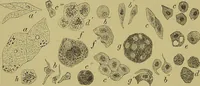 An illustration from Clinical diagnosis : the bacteriological, chemical, and microscopical evidence of disease / By Dr. Rudolf v. Jaksch, ... Translated from the third German edition and enlarged by James Cagney, ... With numerous illustrations (partly in colours). (1893)